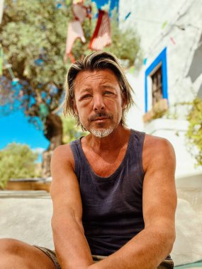 Bronzlaşmış sarışın bir adamın şişmiş yüzü gri sakallı, beyaz bir İspanyol evinin önünde oturuyor. Eşek arısı soktu..