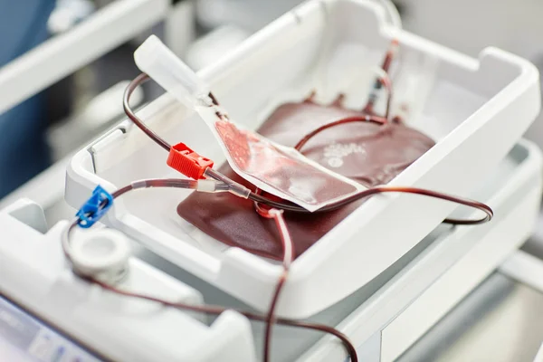 在献血中心关闭装在托盘中的充血袋 复制空间 — 图库照片