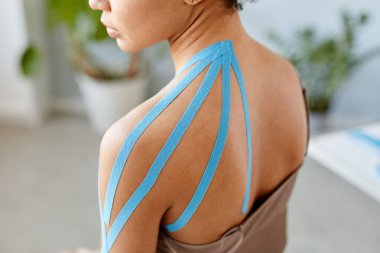 Close up of young black woman with physio tape on shoulder in rehabilitation therapy, copy space clipart