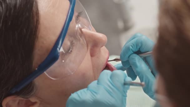 Closeup Van Beoefenaar Der Tandheelkunde Inspecteren Tanden Mondholte Van Vrouwelijke — Stockvideo