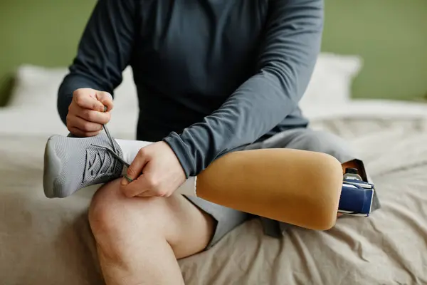 Close Man Prosthetic Leg Tying Shoelaces While Sitting Bed Getting — Stock Photo, Image