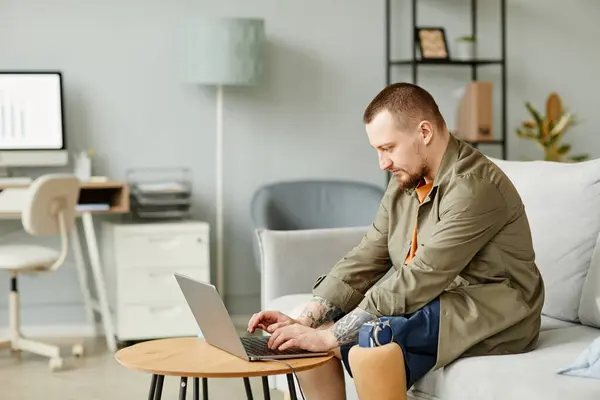 Side View Portrait Man Prosthetic Leg Using Laptop While Working — Stock Photo, Image