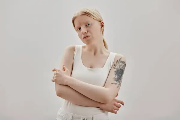 Minimal Waist Portrait Ethereal Girl Albinism Posing White Background — Stock Photo, Image