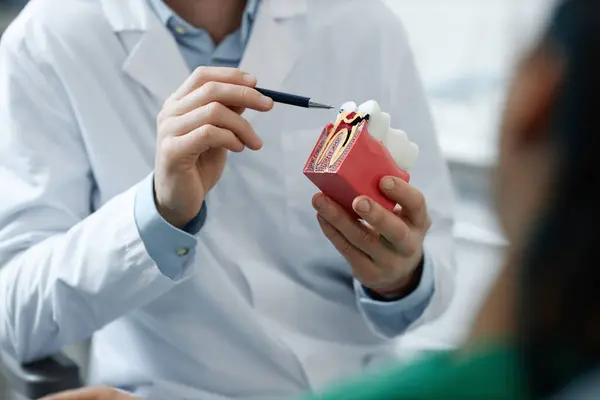 Крупный План Неузнаваемого Стоматолога Держащего Руках Зубную Модель Время Консультации — стоковое фото