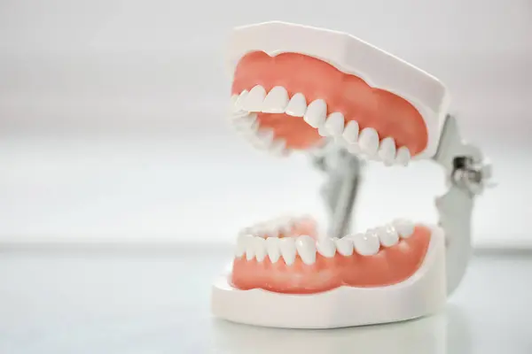 Açık Çene Diş Modelinin Yakın Plan Resmi Beyaz Kopyalama Alanı — Stok fotoğraf