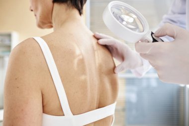 Dermatoloji kliniğindeki kadın hastayı muayene ederken, doktorun elinde büyüteç varken yakın plan.
