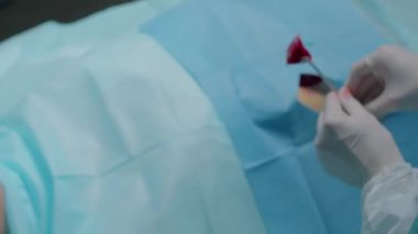 Profesyonel cerrah ekibinin ciddi ameliyatlar gerçekleştirdiği, metal tepsiye kanlı pamuk çubukları yerleştirdiği ve birbirlerine cerrahi aletler ve enstrümanlar verdiği yukarıdan bir çekim.