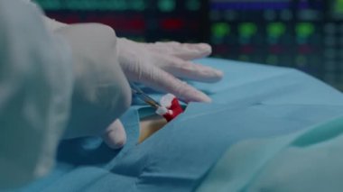 Ameliyat odasında ameliyat sırasında kesi yerine kan emmek için pamuk çubuğu kullanan tanınmayan bir cerrah.