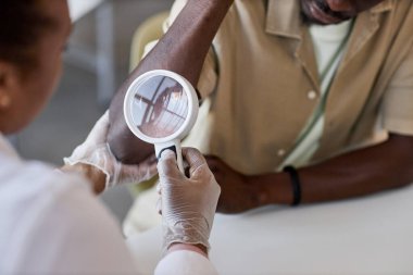 Kadın doktoru cildiyeci olarak kapatın klinikteki hastayı muayene edin ve büyüteç kopyalama alanı kullanın.