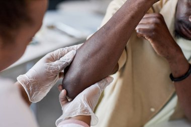 Klinikteki fotokopi odasında hastaların dirseklerini muayene eden tanınmayan cildiyecilere yakın çekim.