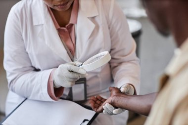 Klinikte muayenede hastaların kollarını incelerken büyüteç kullanan tanınmayan cildiyecileri kapatın.