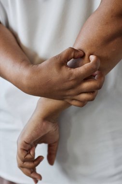 Afrika kökenli Amerikalı bir kadının el ve kollarını kaşıyarak cilt tahrişinden muzdarip olduğu dikey yakın plan.