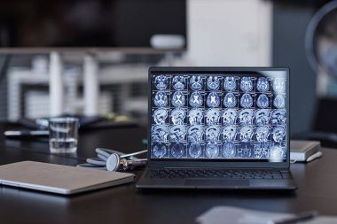 Nörolojistlerin röntgen taraması yapan arka plan görüntüleri. Hastanın beyin taraması. Tıp bürosundaki toplantı masasında.