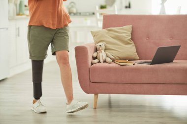 Bacak protezi olan modern bir kadının düşük kesimli portresi.