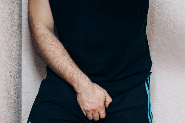 Krankheiten Des Magens Kerl Hält Seine Hand Vor Schmerzen Bauch — Stockfoto