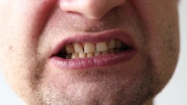 Adamın ağzı kamera karşısında buruşuyor. Tıraşsız bir yüz.