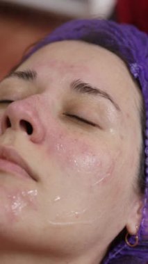 Akne patlaklarının tedavisi. Kozmetoloji prosedürleri. Yüz gerdirme. Vücut temizliği. Aygıt temizleme