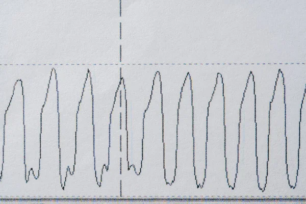 画像は 心呼吸睡眠モニタリングの科学的な心臓グラフを示しています 心拍数または心拍数 紙のグラフ 健康診断心臓グラム閉鎖 — ストック写真