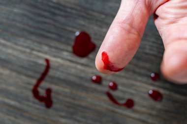 Parmağında bıçak yarasıyla yaralanmış. Yaralı parmak ve açık kesik yarası. Parmağını kapat. İnsan eli kesilir. Parlak kırmızı kanla kanıyor.