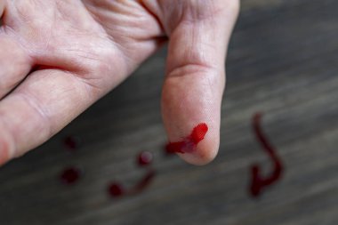 Parmağında bıçak yarasıyla yaralanmış. Yaralı parmak ve açık kesik yarası. Parmağını kapat. İnsan eli kesilir. Parlak kırmızı kanla kanıyor.