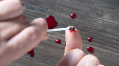 Parmağındaki bıçak yarasının dezenfeksiyonu tentürdiyot ile, yakın çekim. Kesik bir yarayı iyot içeren bir bezle tedavi etmek. Parmağında kan var.