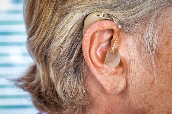 Hearing impairment may increase the risk of dementia: Fact or Myth?