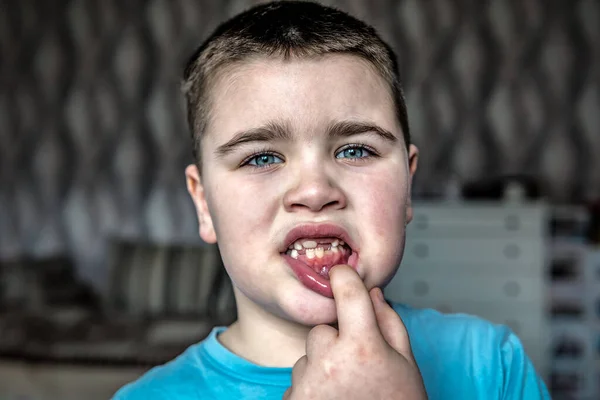Funny boy showing a fallen tooth. Loss of teeth, concept of dental problems