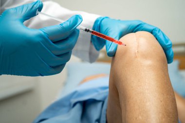 Asyalı doktor, Hyaluronic asit trombosit enjekte ederek yaşlı kadının dizine zengin plazma enjekte etti..