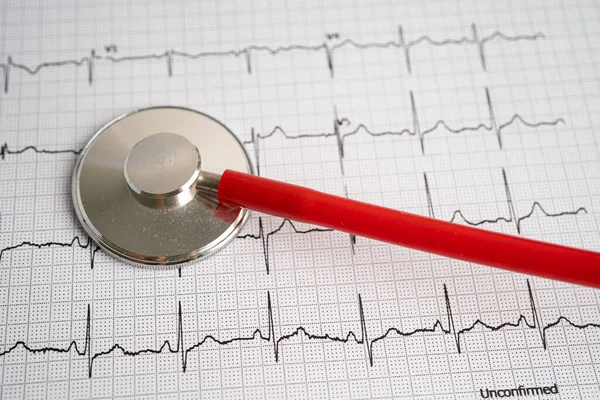 Estetoscopio Electrocardiograma Ecg Con Corazón Rojo Onda Cardíaca Ataque Cardíaco —  Fotos de Stock