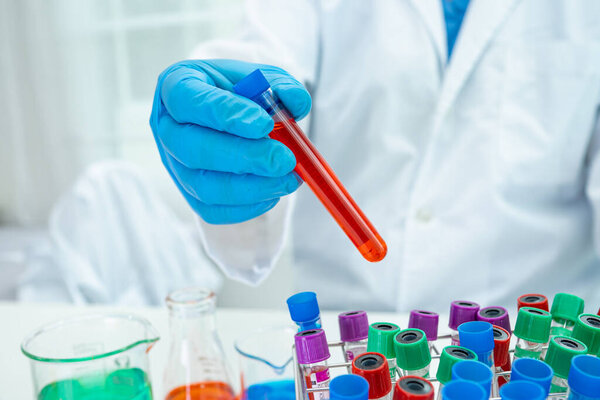 Scientist holding and analysis tube of micro biological sample with a microscope in laboratory for doctor in the world.