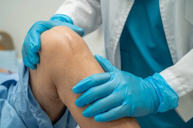 Asyalı yaşlı ya da yaşlı kadın hasta yaralarını gösteriyor. Diz eklemi ameliyatıyla değiştirilmiş. Hemşirelik hastanesi koğuşunda yatağında eklem iltihabı var..