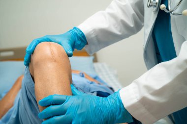 Asyalı yaşlı ya da yaşlı kadın hasta yaralarını gösteriyor. Diz eklemi ameliyatıyla değiştirilmiş. Hemşirelik hastanesi koğuşunda yatağında eklem iltihabı var..