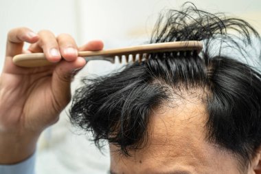 Bald in the head and begin no loss hair glabrous of mature Asian business smart active office man.