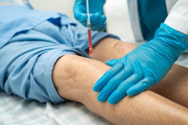 Asyalı doktor, Hyaluronic asit trombosit enjekte ederek yaşlı kadının dizine zengin plazma enjekte etti..