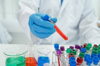 Bilimsel kimya laboratuvarında kırmızı renkli sıvı çözeltisi olan konik cam şişeyi elinde tutan bilim adamı..