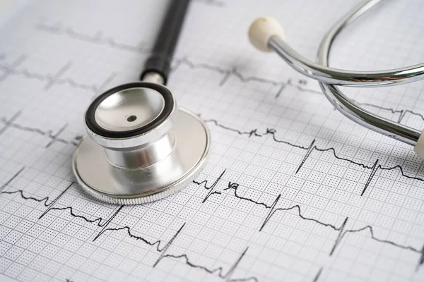 心电图 心脏病 心电图报告的听诊器 — 图库照片