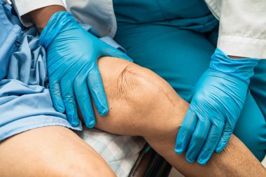 Asyalı yaşlı kadın hasta yaralarını gösteriyor. Diz eklemi ameliyatıyla değiştirilmiş. Hemşirelik hastanesi koğuşunda yatağın üzerine dikiş atılmış..