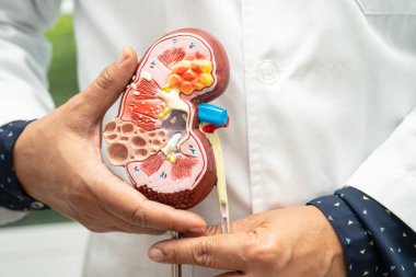 Böbrek hastalığı, kronik böbrek hastalığı, hastanede çalışmak ve tedavi etmek için doktor holding modeli..