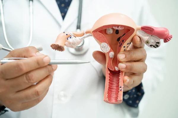 stock image Uterus, doctor holding anatomy model for study diagnosis and treatment in hospital.