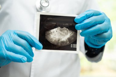 Rahim ve yumurtalık, hastanede teşhis ve tedavi için anatomi modeli ve ultrason resmi tutan doktor..