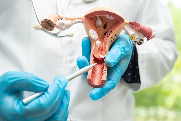 stock image Uterus, doctor holding anatomy model for study diagnosis and treatment in hospital.