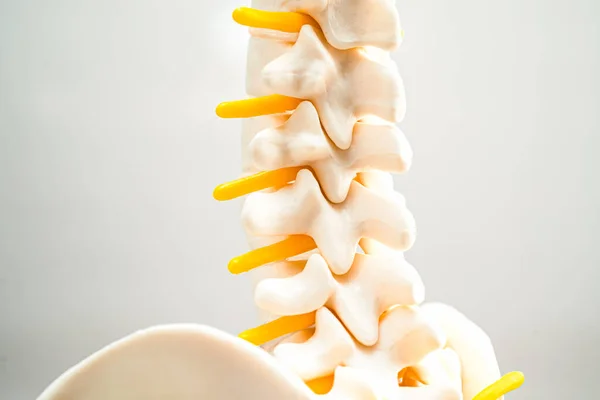 腰椎は関節のディスクの断片 脊髄神経 骨を脱臼させた 整形外科における治療医療モデル ロイヤリティフリーのストック写真