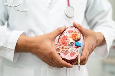 Böbrek hastalığı, kronik böbrek hastalığı, hastanede çalışmak ve tedavi etmek için doktor holding modeli..