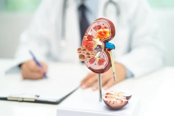 stock image Kidney disease, Chronic kidney disease ckd, Doctor with human model to study and treat in hospital.