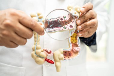 Bağırsak, apandis ve sindirim sistemi, hastanede teşhis ve tedavi için anatomi modelini tutan doktor..