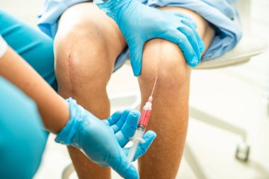 Asyalı doktor, Hyaluronic asit trombosit enjekte ederek yaşlı kadının dizine zengin plazma enjekte etti..