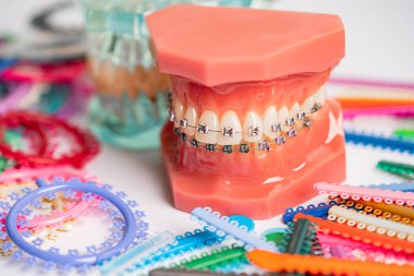 Ortodontik bağlar halkalar ve kravatlar, diş hekimliği üzerine çalışan dişçi için model..