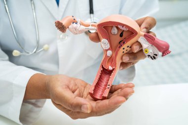 Rahim, hastanede teşhis ve tedavi için anatomi modeli olan bir doktor..
