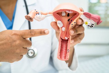 Rahim, hastanede teşhis ve tedavi için anatomi modeli olan bir doktor..