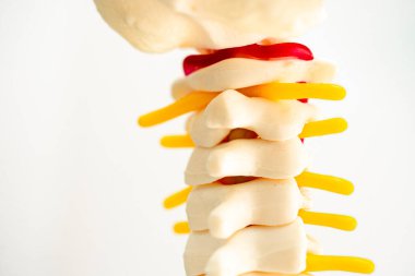 Bel omurgası yerinden oynamış disk parçası, omurilik ve kemik. Ortopedi bölümünde tedavi için kırpma yolu olan beyaz arka plan modeli.